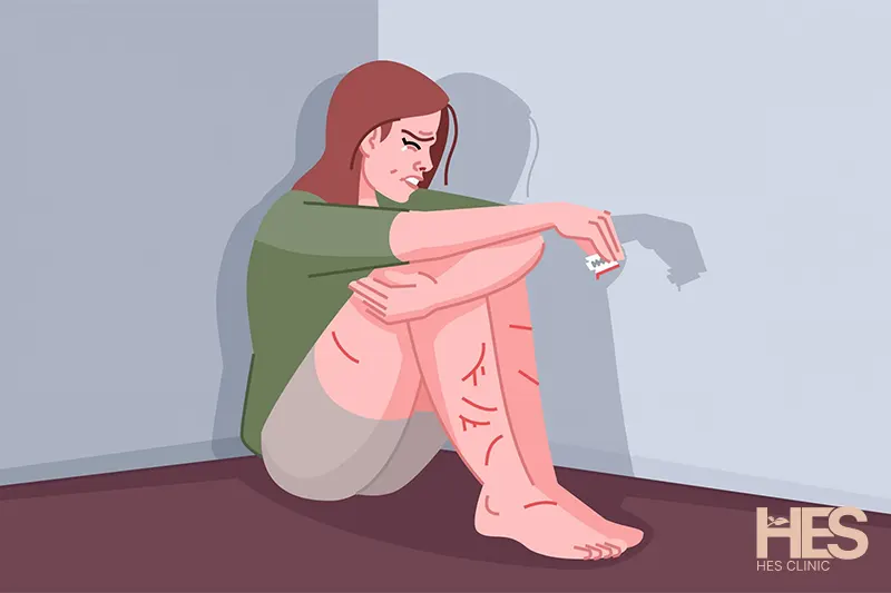 خودزنی موقع عصبانیت چیست؟