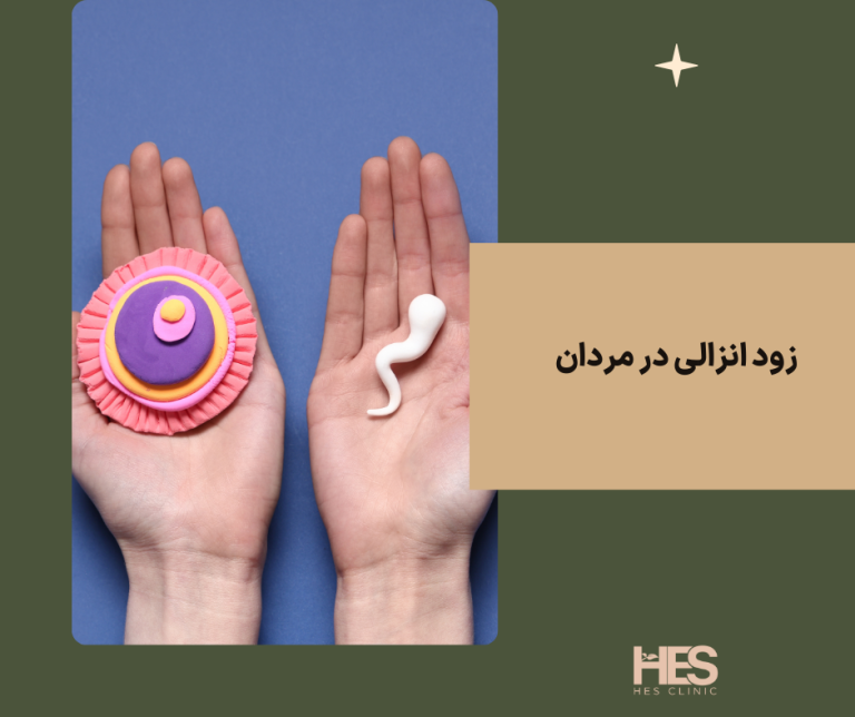 زود انزالی در مردان